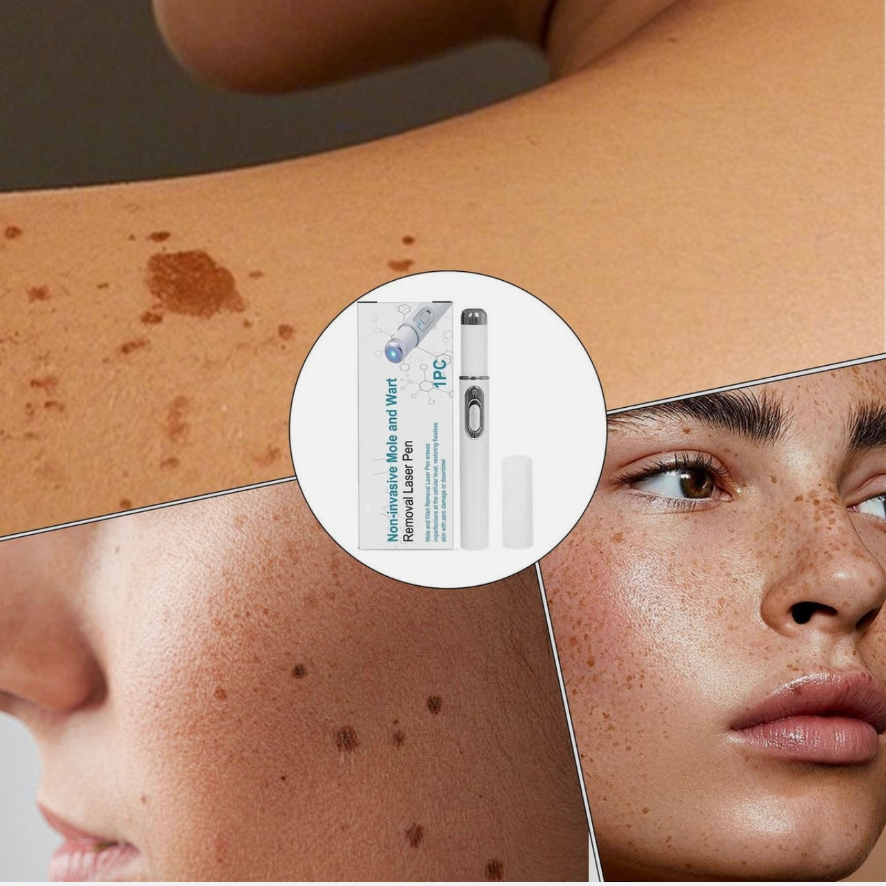 Non-Invasive Mole and
Wart Removal Laser Pen in just 2499